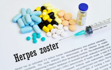 herpes-zoster-causas-sintomas-prevencion
